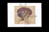 Stitch Your Brain